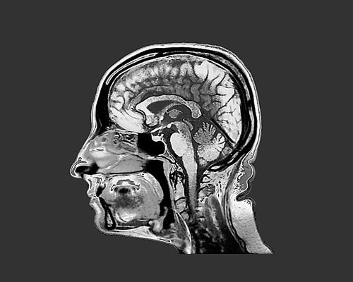 图片来源:Zephyr/Science Photo Library